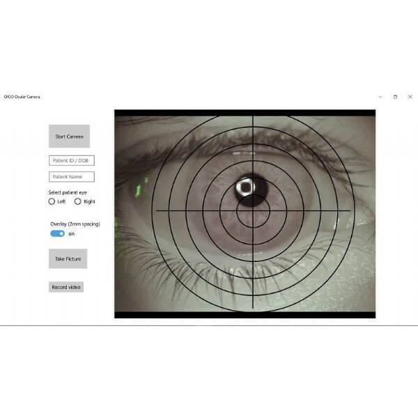 Ocu-Cam UltraHD | OICO | oico.co.uk